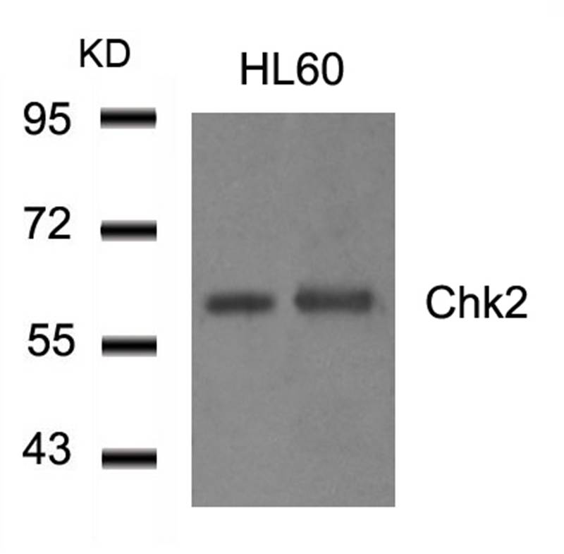 Rabbit Polyclonal Antibody to Chk2(Ab-516)