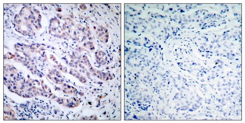 Rabbit Polyclonal Antibody to TYK2(Ab-1054)