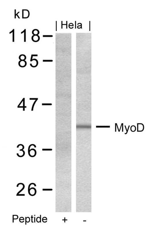 Rabbit Polyclonal Antibody to MyoD(Ab-200)
