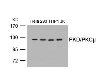 Rabbit Polyclonal Antibody to PKD/PKCm(Ab-738)