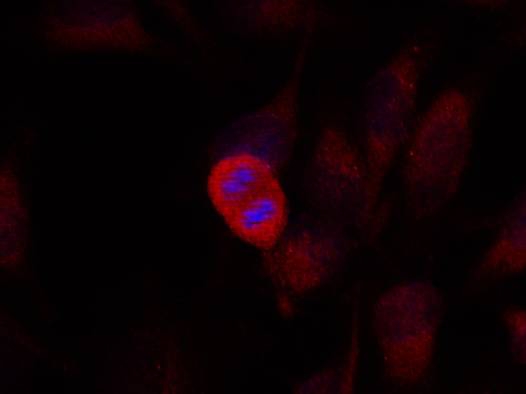 Rabbit Polyclonal Antibody to SEK1/MKK4(Ab-261)