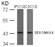 Rabbit Polyclonal Antibody to SEK1/MKK4(Ab-80)