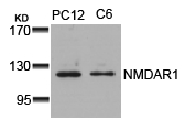 Rabbit Polyclonal Antibody to NMDAR1(Ab-896)