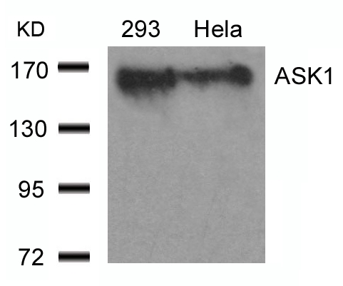 Rabbit Polyclonal Antibody to ASK1(Ab-966)