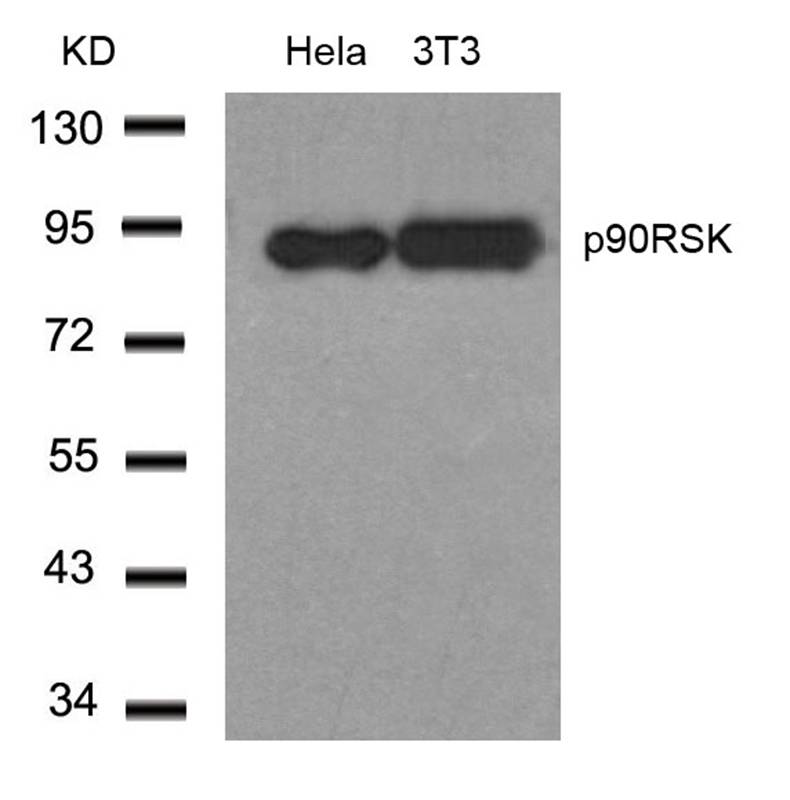Rabbit Polyclonal Antibody to p90RSK(Ab-348)