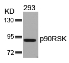 Rabbit Polyclonal Antibody to p90RSK(Ab-352)