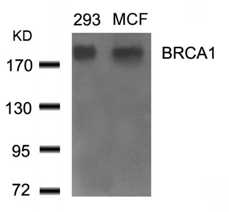 Rabbit Polyclonal Antibody to BRCA1(Ab-1524)