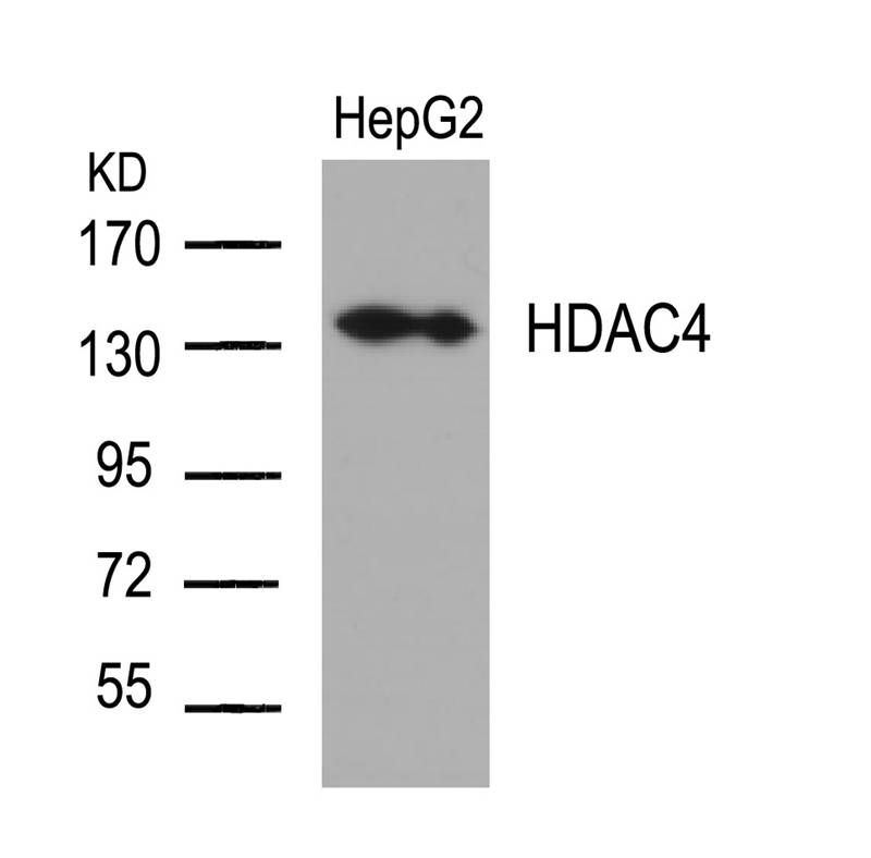 Rabbit Polyclonal Antibody to HDAC4(Ab-632)