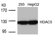 Rabbit Polyclonal Antibody to HDAC5(Ab-498)