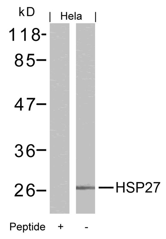 Rabbit Polyclonal Antibody to HSP27(Ab-15)