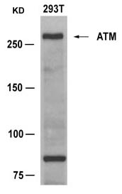Rabbit Polyclonal Antibody to ATM(Ab-1981)