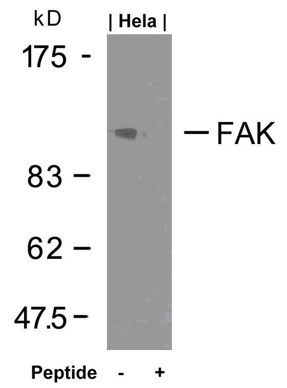 Rabbit Polyclonal Antibody to FAK(Ab-925)