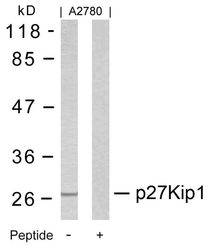 Rabbit Polyclonal Antibody to p27Kip1(Ab-10)