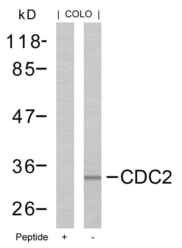 Rabbit Polyclonal Antibody to CDC2(Ab-161)