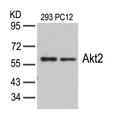 Rabbit Polyclonal Antibody to Akt2(Ab-474)