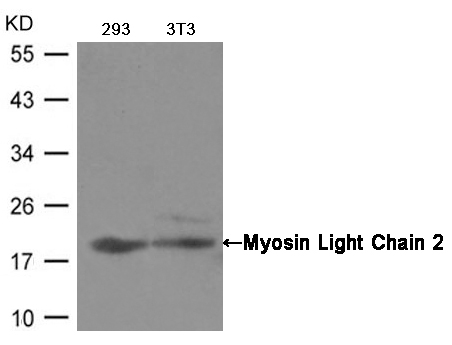 Rabbit Polyclonal Antibody to Myosin Light Chain 2 (Ab-19)