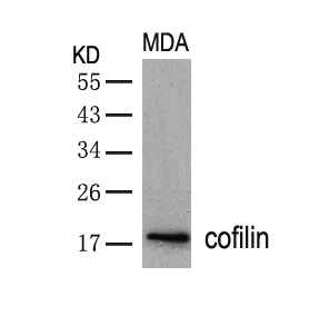 Rabbit Polyclonal Antibody to cofilin(Ab-3)