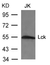Rabbit Polyclonal Antibody to Lck(Ab-394)