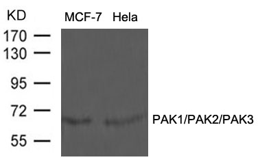 Rabbit Polyclonal Antibody to PAK1/PAK2/PAK3(Ab-423/402/421)