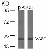 Rabbit Polyclonal Antibody to VASP(Ab-239)