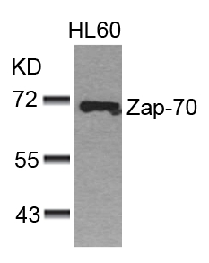Rabbit Polyclonal Antibody to Zap-70(Ab-493)