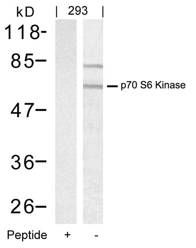 Rabbit Polyclonal Antibody to p7S6 Kinase(Ab-389)