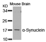 Rabbit Polyclonal Antibody to a-Synuclein(Ab-129)