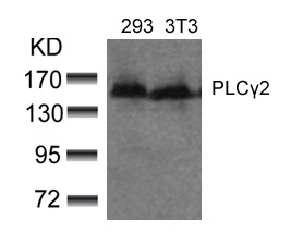 Rabbit Polyclonal Antibody to PLCg2(Ab-753)