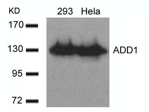 Rabbit Polyclonal Antibody to ADD1(Ab-726)