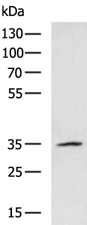 Rabbit Polyclonal Antibody to Ephrin-B2(Ab-330)
