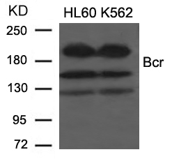 Rabbit Polyclonal Antibody to Bcr(Ab-177)