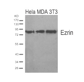 Rabbit Polyclonal Antibody to Ezrin(Ab-567)