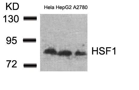 Rabbit Polyclonal Antibody to HSF1(Ab-307)