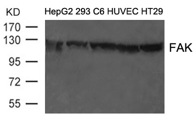 Rabbit Polyclonal Antibody to FAK(Ab-397)