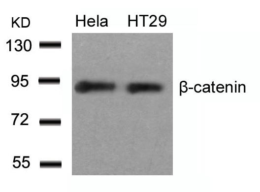 Rabbit Polyclonal Antibody to b-Catenin(Ab-33)