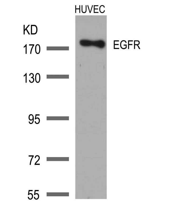 Rabbit Polyclonal Antibody to EGFR(Ab-1172)