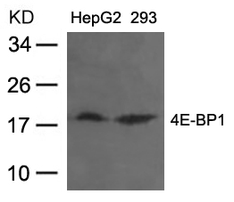 Rabbit Polyclonal Antibody to 4E-BP1 (Ab-37)