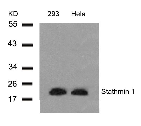 Rabbit Polyclonal Antibody to Stathmin1(Ab-25)