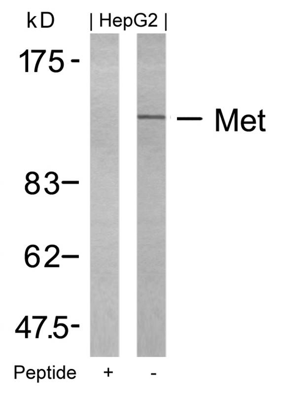 Rabbit Polyclonal Antibody to Met(Ab-1234)