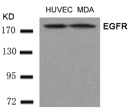 Rabbit Polyclonal Antibody to EGFR(Ab-1197)