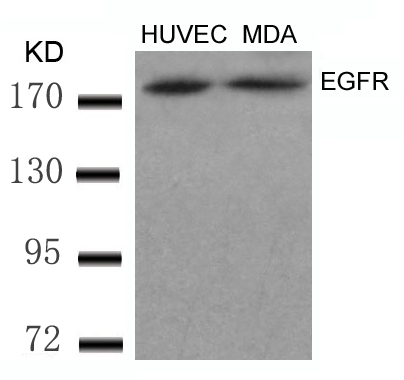 Rabbit Polyclonal Antibody to EGFR(Ab-869)