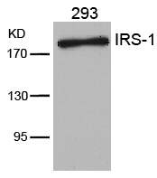 Rabbit Polyclonal Antibody to IRS-1(Ab-636)