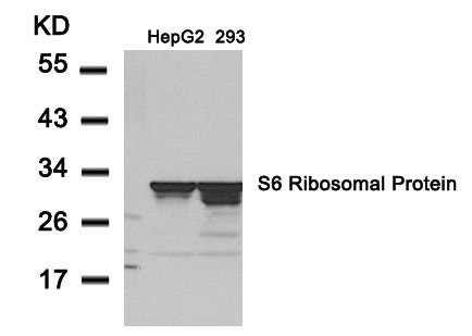 Rabbit Polyclonal Antibody to S6 Ribosomal Protein(Ab-235)
