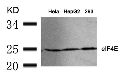 Rabbit Polyclonal Antibody to eIF4E(Ab-209)