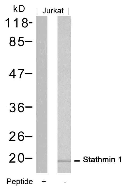 Rabbit Polyclonal Antibody to Stathmin1(Ab-16)