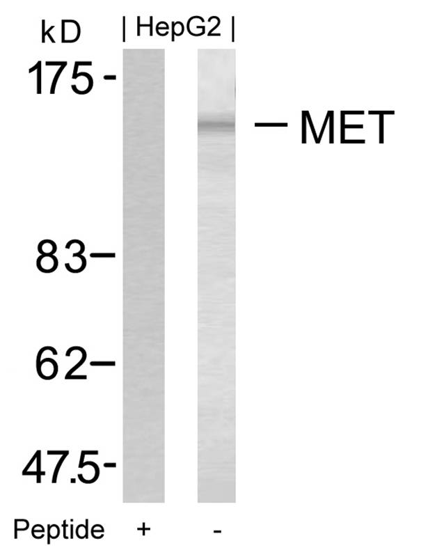 Rabbit Polyclonal Antibody to Met(Ab-1349)