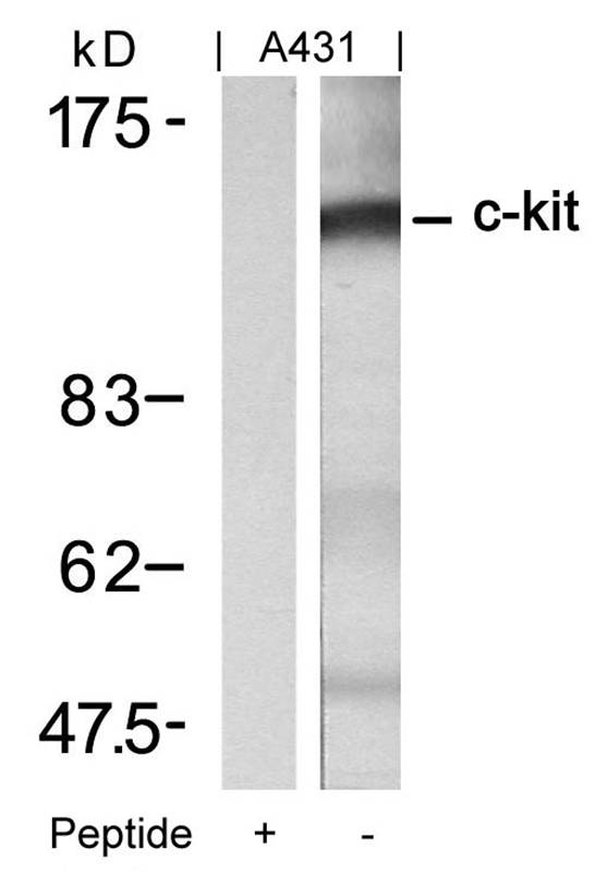 Rabbit Polyclonal Antibody to c-Kit(Ab-721)