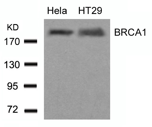 Rabbit Polyclonal Antibody to BRCA1(Ab-1423)