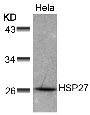 Rabbit Polyclonal Antibody to HSP27(Ab-78)