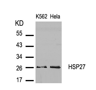 Rabbit Polyclonal Antibody to HSP27(Ab-82)